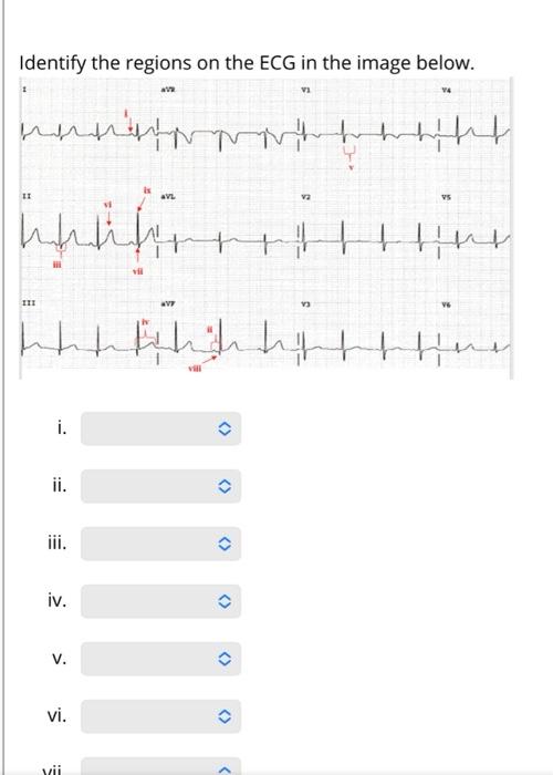 Ecg regions online