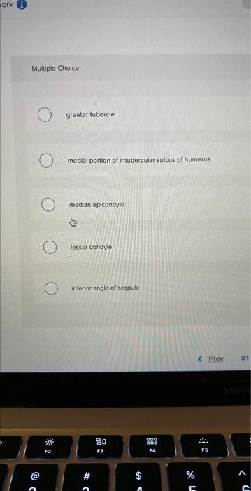 Multiple Choice
greater tubercle
medial portion of intubercular sulcus of humerus
median epicondyle
lesser condyle
intecior a