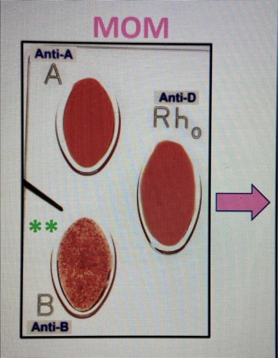 The Blood Typing Game - about blood groups, blood typing and blood  transfusions