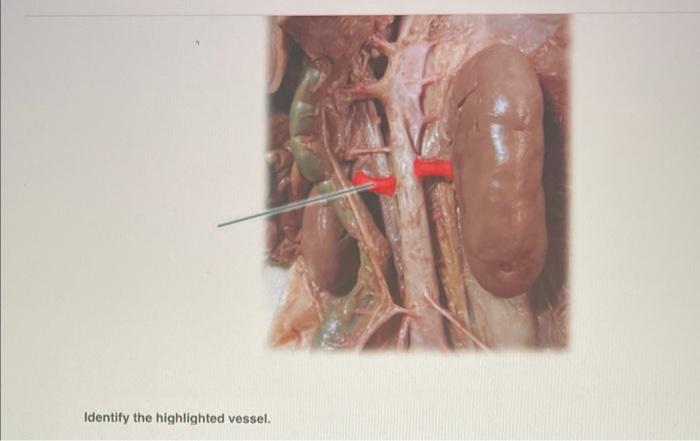 Identify the highlighted vessel.