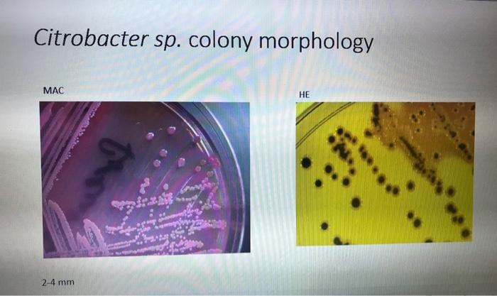 Solved Escherichia coli colony morphology HE MAC 1-5mm | Chegg.com