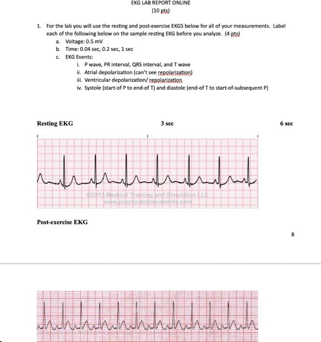 Ekg Lab Report Online 10 Pts 1 For The Lab You