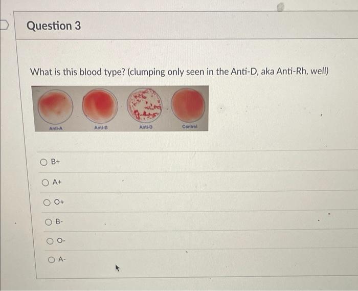 solved-3-question-3-what-is-this-blood-type-clumping-chegg