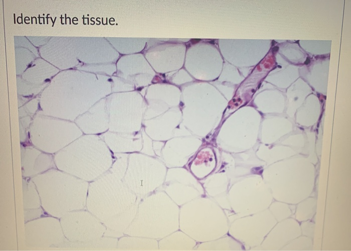 Solved Identify The Tissue. | Chegg.com