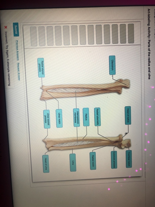 Solved Art-labeling Activity: Parts of the radius and ulna | Chegg.com