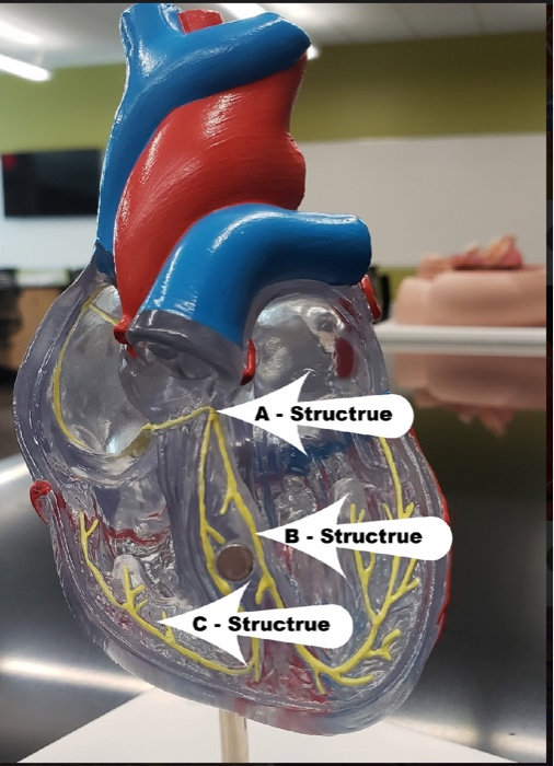 Solved Ao B - Structure C- Structure A - Structure A - | Chegg.com