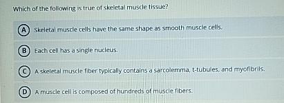 Solved Which of the following is true of skeletal muscle | Chegg.com