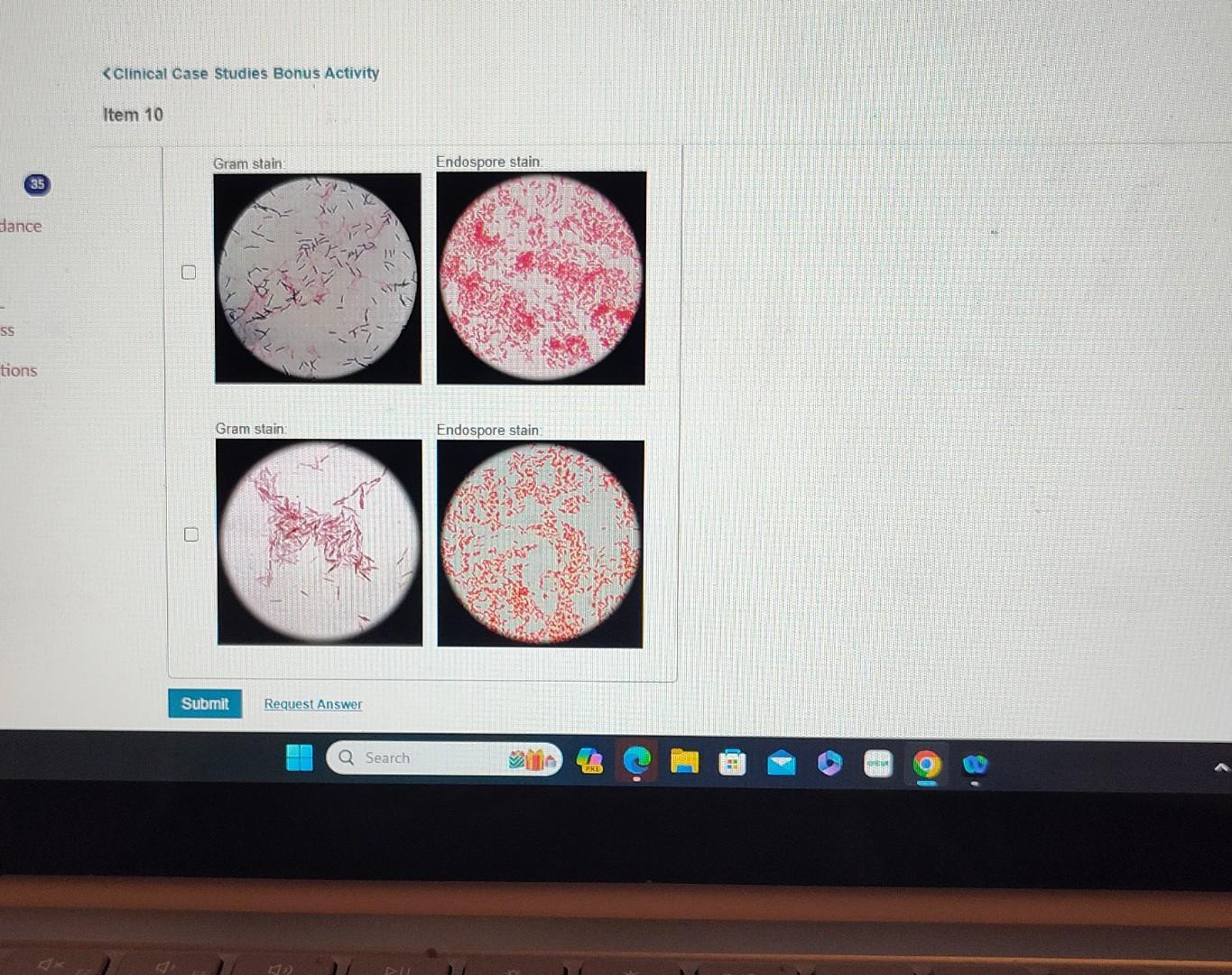 Solved Bacillus anthracis, like other Bacillus species, are | Chegg.com