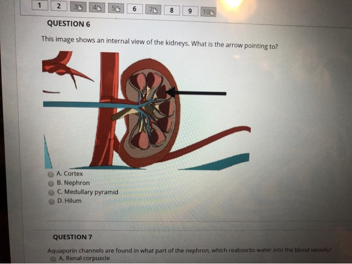 solved-question-1-this-is-an-image-of-what-structure-in-the-chegg