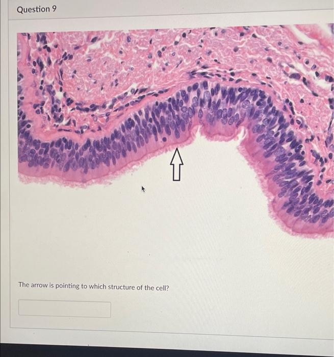 Solved Question 9 슈 The arrow is pointing to which structure | Chegg.com