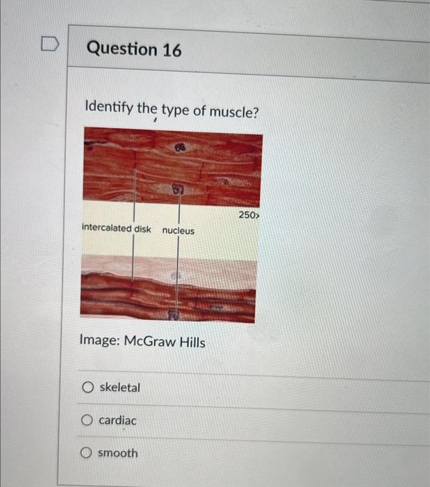 Solved 1. A stroke volume is the amount of blood ejected | Chegg.com