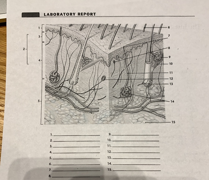 Solved Section A. Matching Match Each Skin Structure In The 