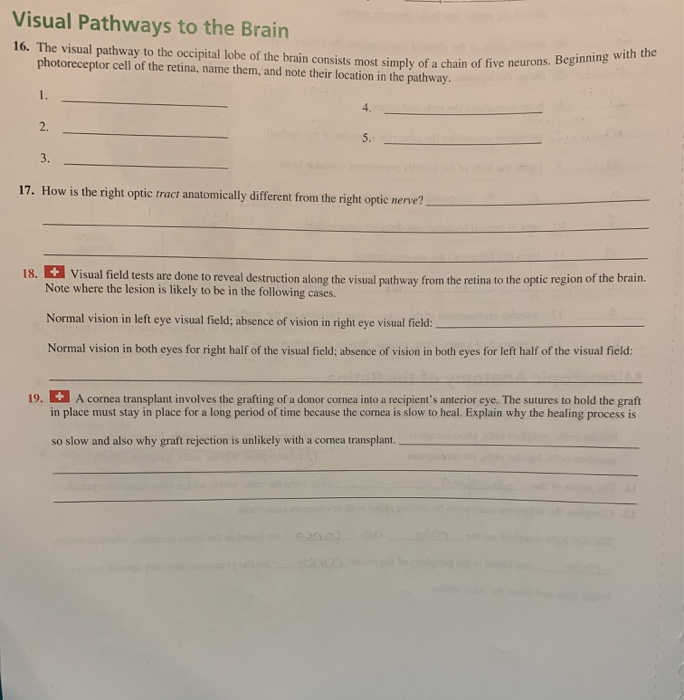 Solved Visual Pathways to the Brain 10. The visual pathway | Chegg.com
