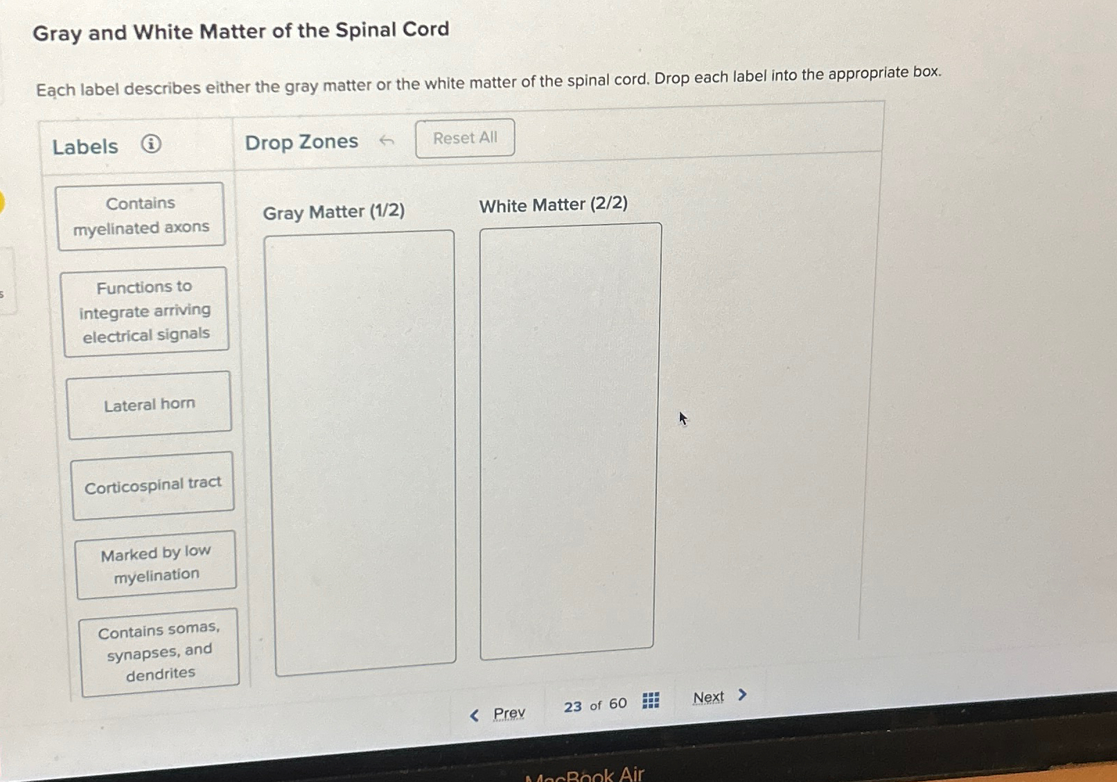 Solved Gray and White Matter of the Spinal CordEach label | Chegg.com