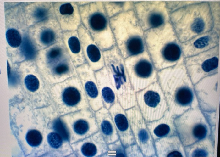 Solved Mitosis EXERCISE 1: OBSERVATION OF MITOSIS IN A PLANT | Chegg.com