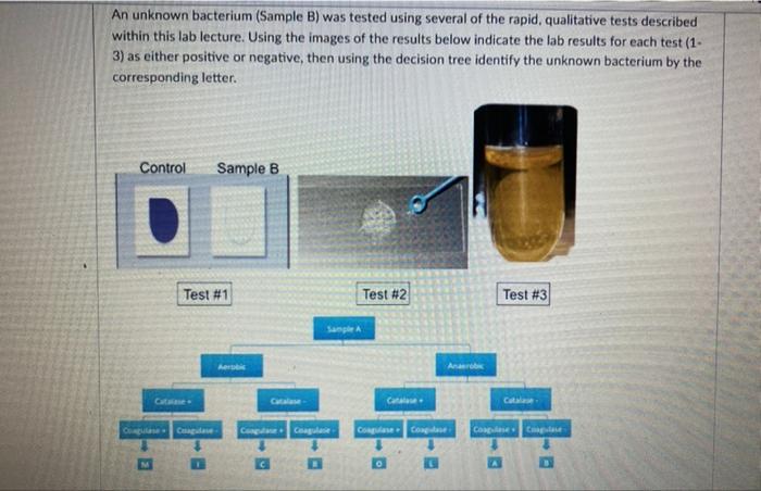 Solved An Unknown Bacterium (Sample B) Was Tested Using | Chegg.com