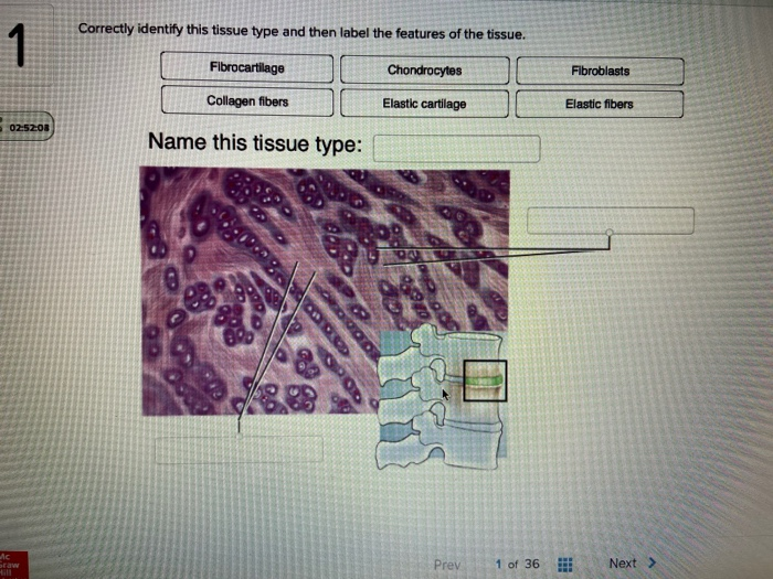 Solved 2 Correctly identify this tissue type and then label | Chegg.com