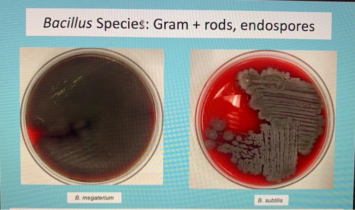 bacillus subtilis blood agar