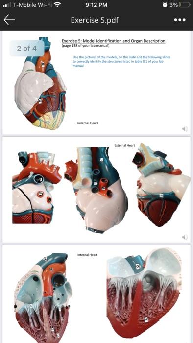 Solved Anatomy of the Cardiovascular System EXERCISE 5. | Chegg.com