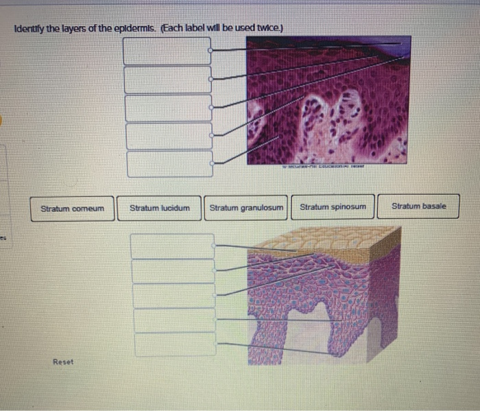 Solved Identify the layers of the epldermls. (Each label | Chegg.com