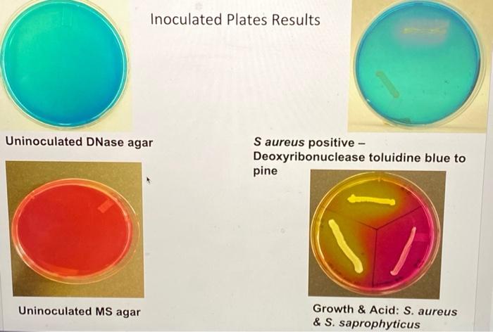 Solved Experiment 40 - Identification of Staphylococci S. | Chegg.com