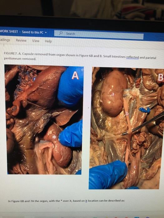 WORK SHEET - Saved to this PC Search ailings Review View Help FIGURE7. A. Capsule removed from organ shown in Figure 6B and B