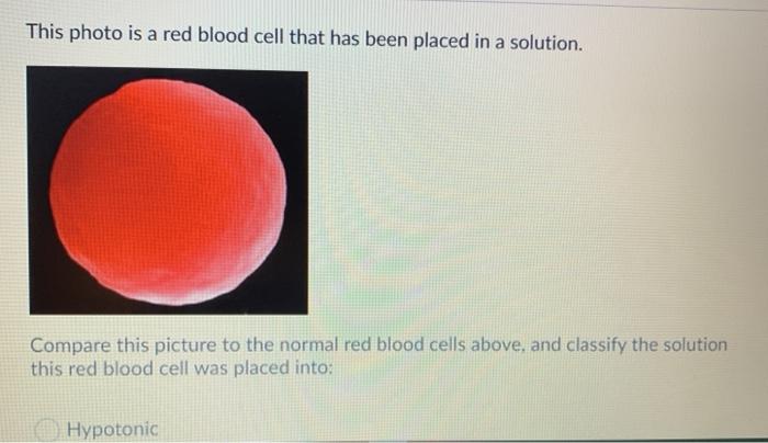 Solved This photo is of red blood cells that have been | Chegg.com