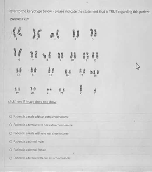 Solved Refer To The Karyotype Below- Please Indicate The 