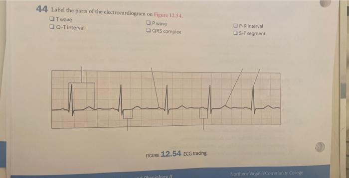 Solved 44. Label the parts of the electrocardiogram on | Chegg.com