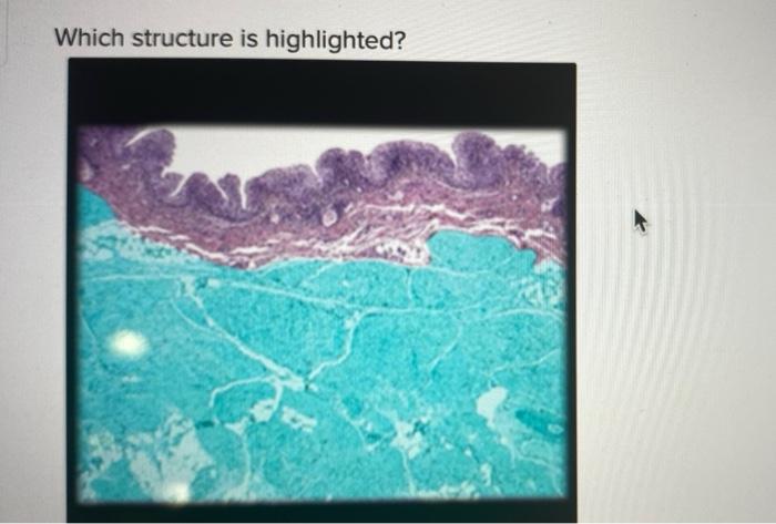 Which structure is highlighted?