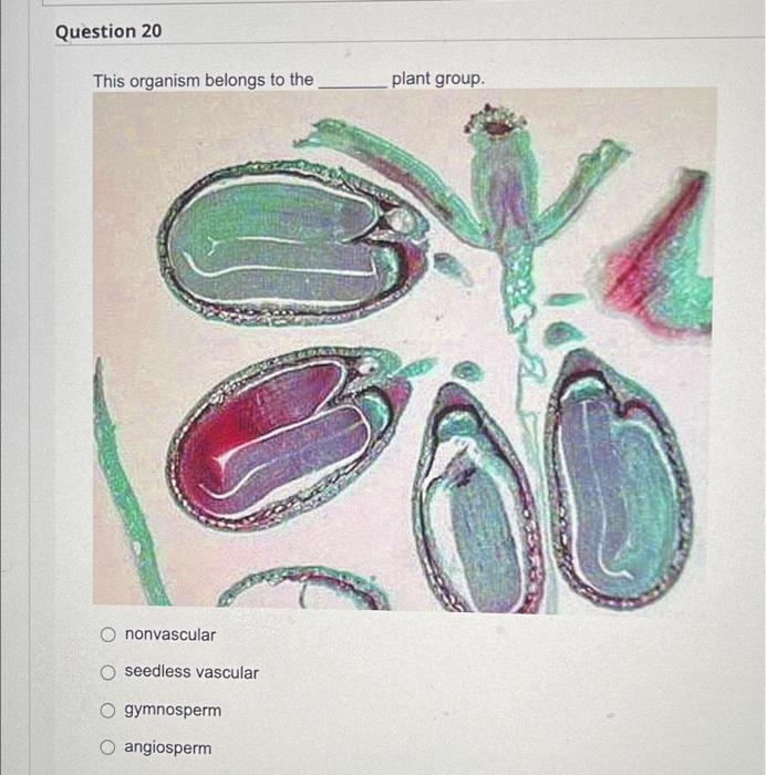 Solved Question 1 Name The Organism Shown In The Picture O | Chegg.com