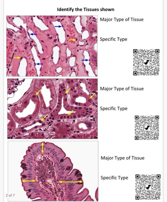 Solved Identify the Tissues shown Major Type of Tissue | Chegg.com
