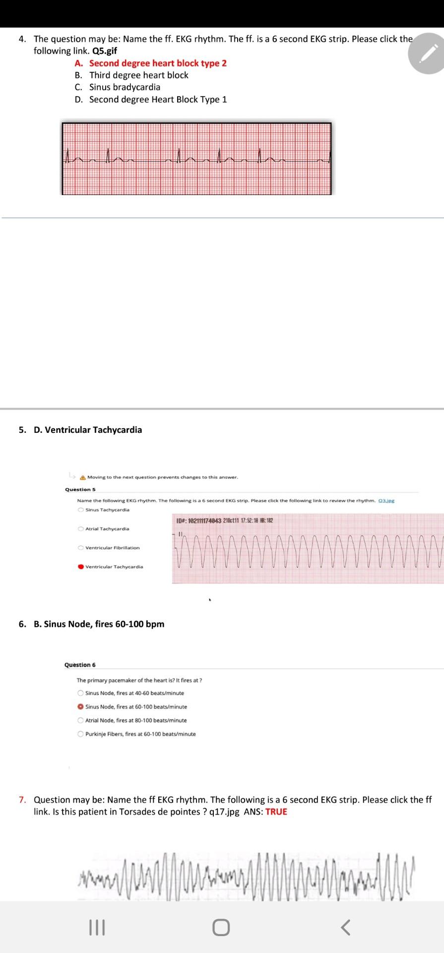 Solved 4 The Question May Be Name The Ff Ekg Rhythm T Chegg Com