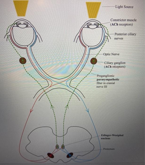 Solved (IV.C) - Pupillary Light Reflex Arc – List the | Chegg.com