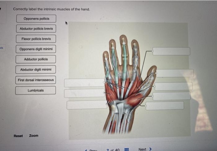 Solved Correctly label the intrinsic muscles of the hand, | Chegg.com