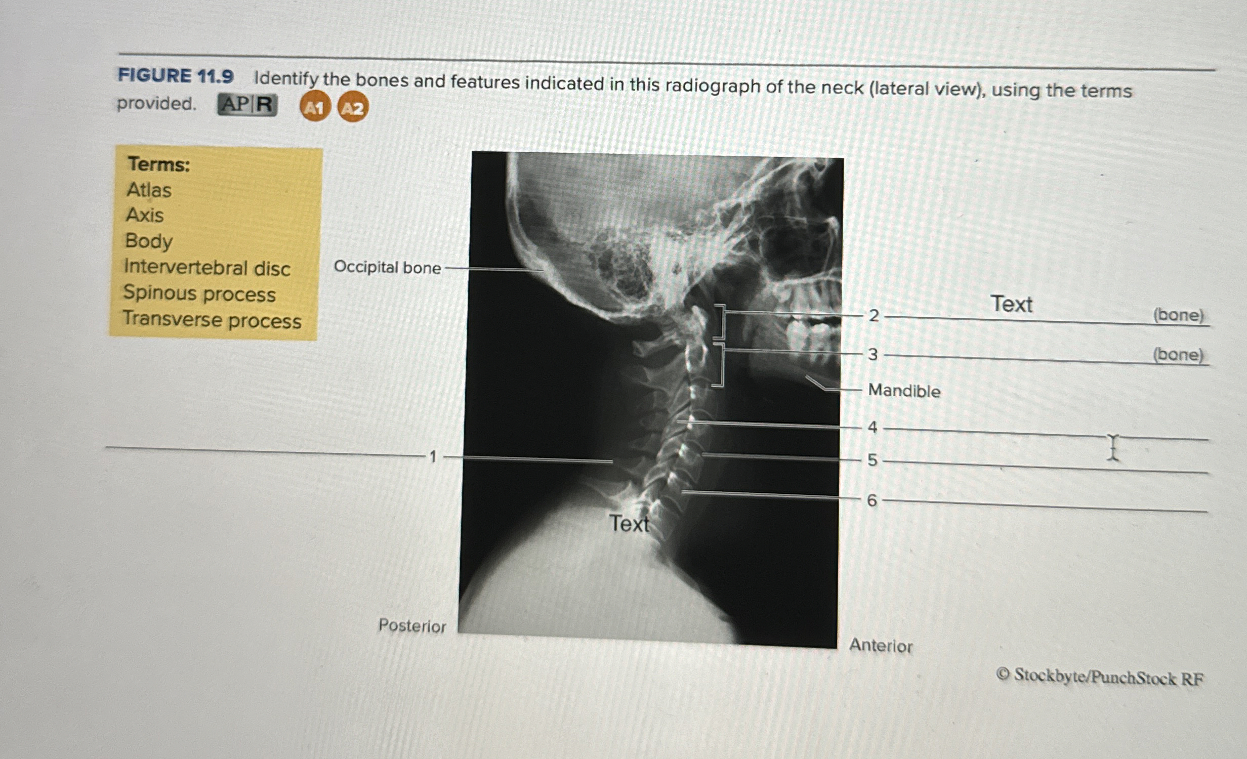 Solved Identify the bones and features indicated in this | Chegg.com