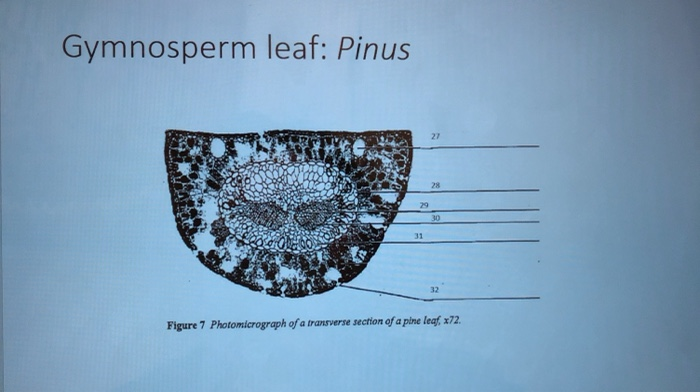 Solved Gymnosperm leaf: Pinus 27 28 30 Figure 7 | Chegg.com