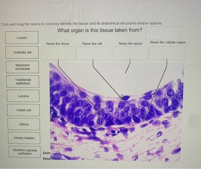 Drag the labels onto the diagram to identify structures associated with the  transitional epithelium of the urinary bladder (exam 2) Diagram