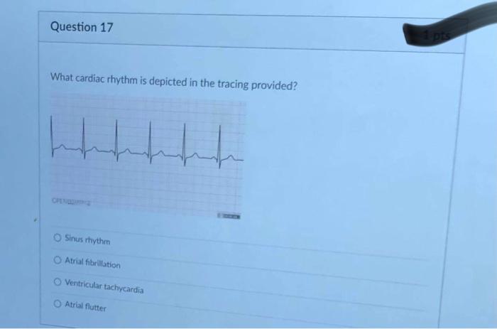 Solved A 47 year old man presents to the emergency | Chegg.com