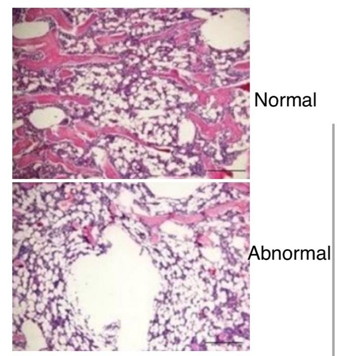 Solved An 80-year-old female with a PMHx of frequent | Chegg.com