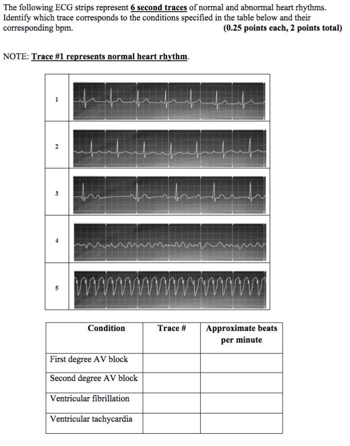 Solved The following ECG strips represent 6 second traces of | Chegg.com
