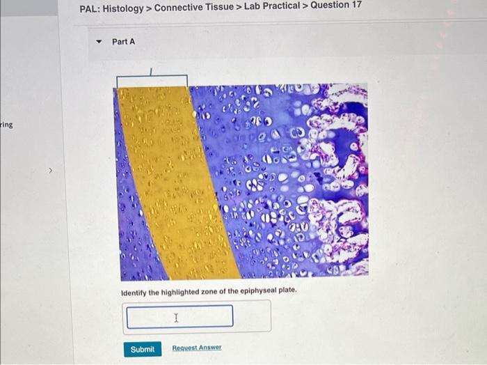 Identify the highlighted zone of the epiphyseal plate.