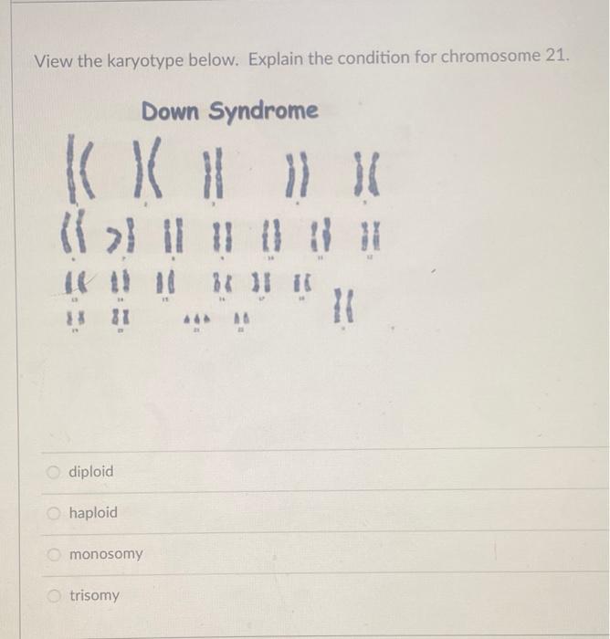 monosomy 21 karyotype