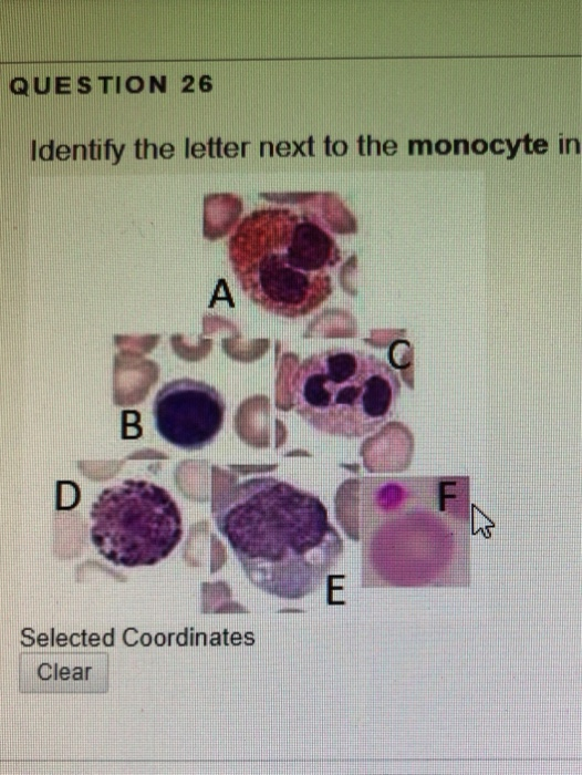 Solved QUESTION 32 Identify the letter pointing to the | Chegg.com