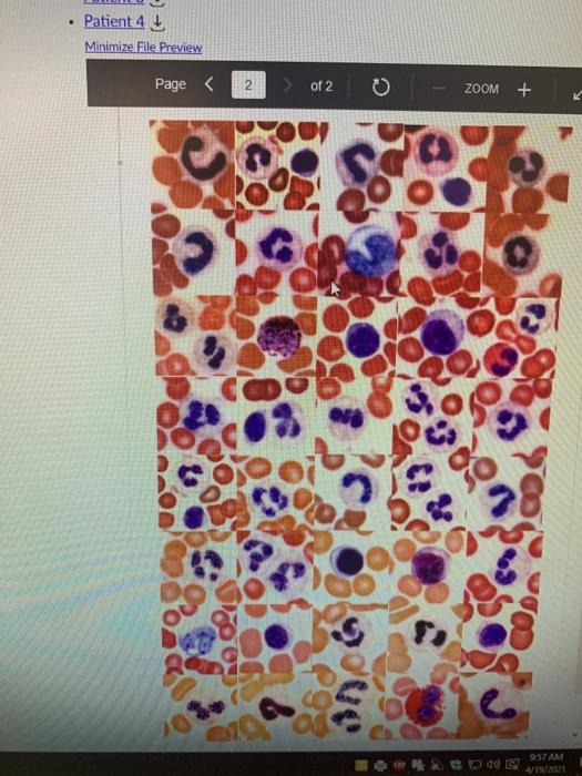 Solved Page 1 of 5 0 ZOOM + Case Study (Blood) Blood is | Chegg.com