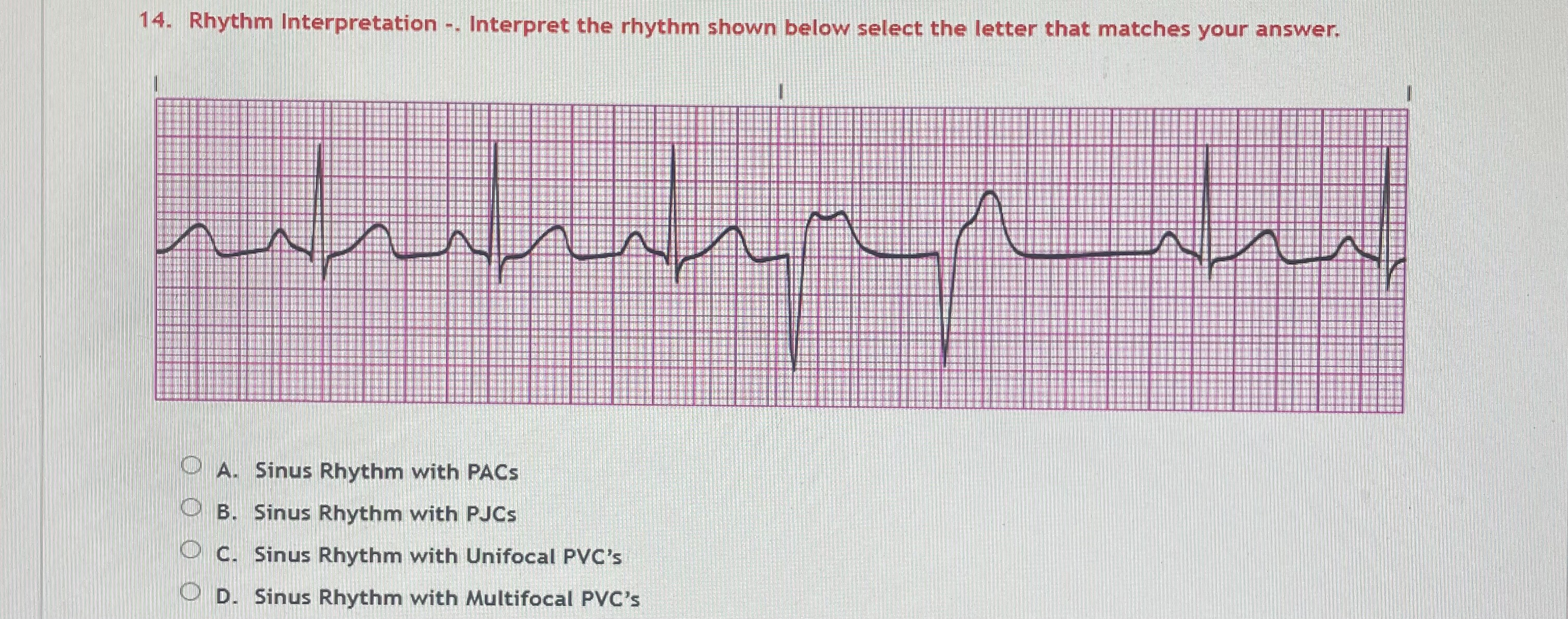 Solved What type of strip 14. ﻿Rhythm Interpretation .