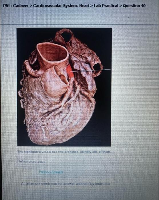 PAL: Cadaver > Cardiovascular System: Heart> Lab Practical > Question 10
The highighted vesised has fwo kerncher tolentify on