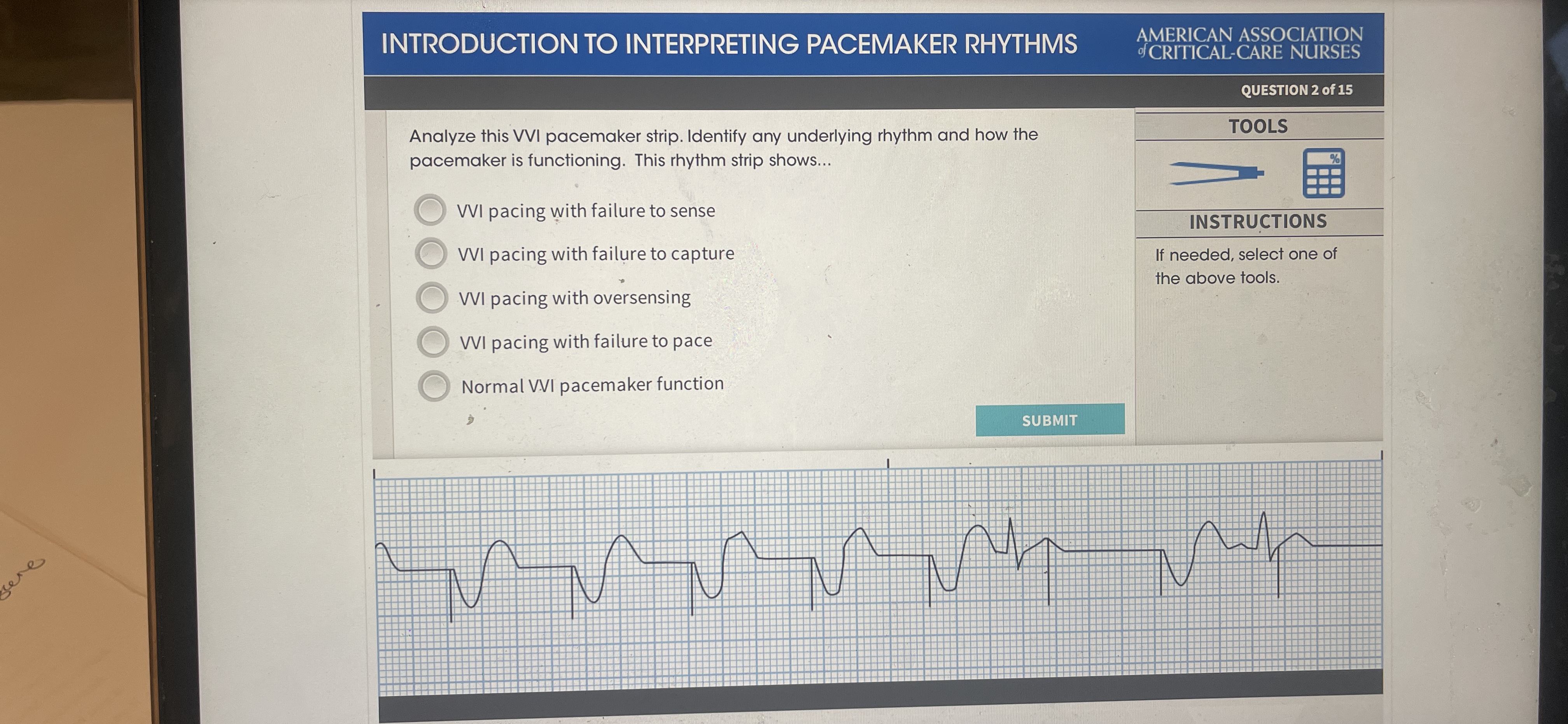 Solved INTRODUCTION TO INTERPRETING PACEMAKER | Chegg.com
