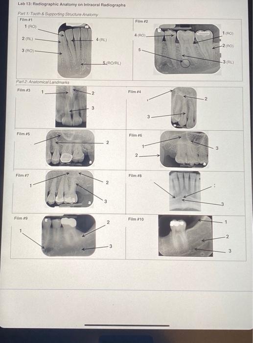 Solved Lab 13 Radiographic Anatomy on Intraoral Radiographs