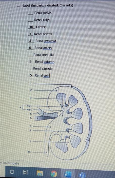 Solved 1 Label the parts indicated: (5 marks) Renal pelvis | Chegg.com